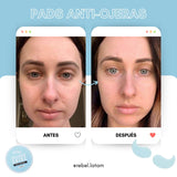 Almohadillas Anti Ojeras Hidrogel Piel Rebelde™